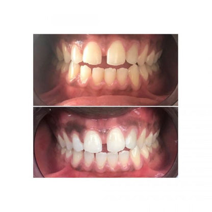 Dentifrice Sensitive à l'Aloe Vera